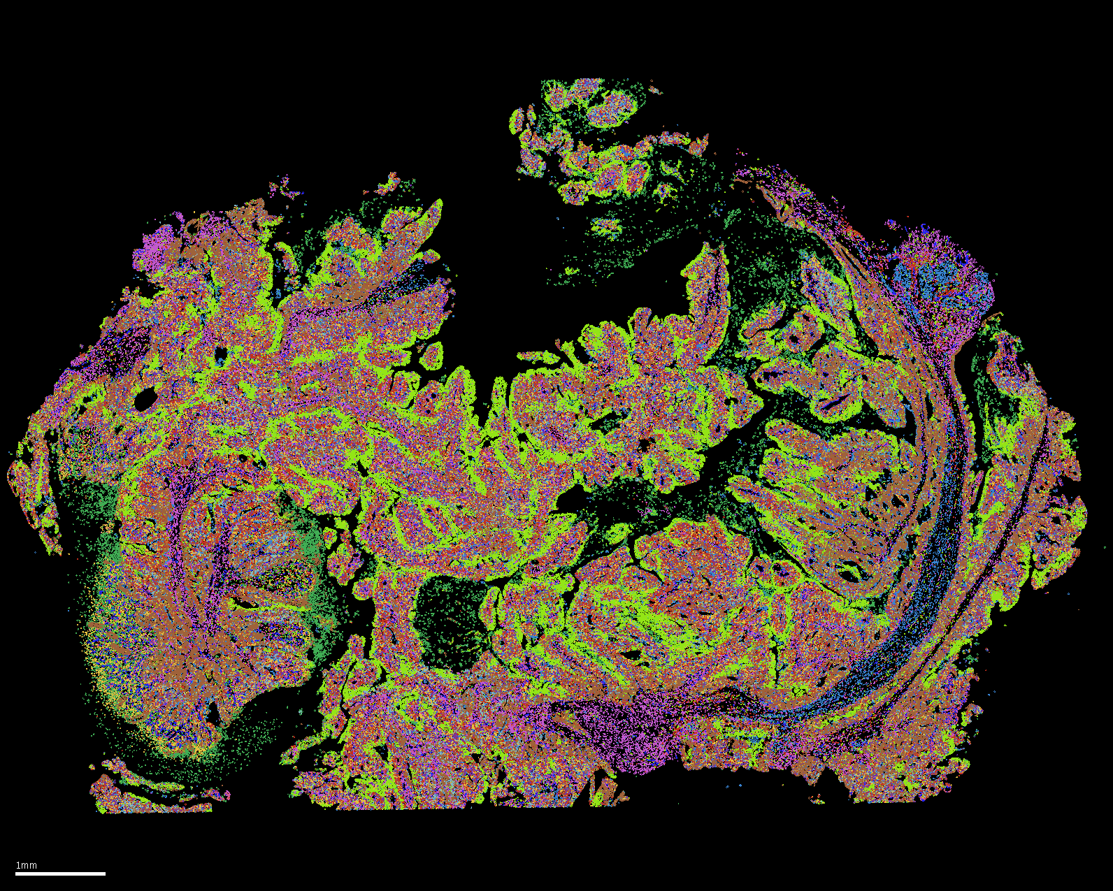 Vizgen VizgenSpatial-distribution-of-cell-types_colon-cancer.png